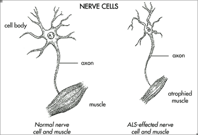 sink als diagram motor neurons[1]